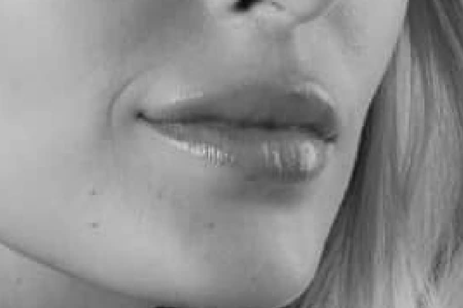 Lippen opvullen
